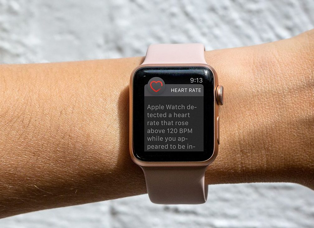 Apple Watch taşikardi