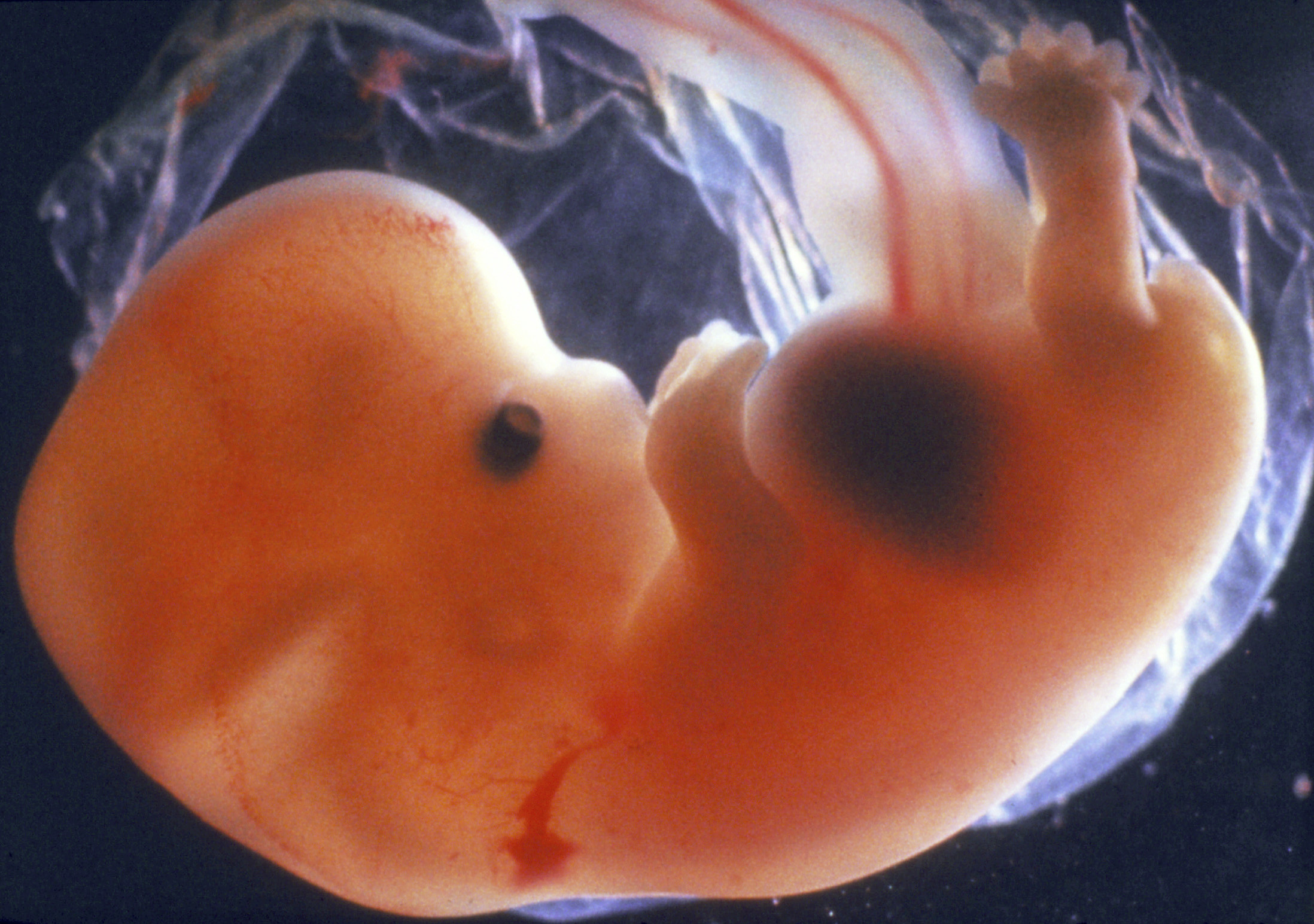 İnsan embriyosu - 1