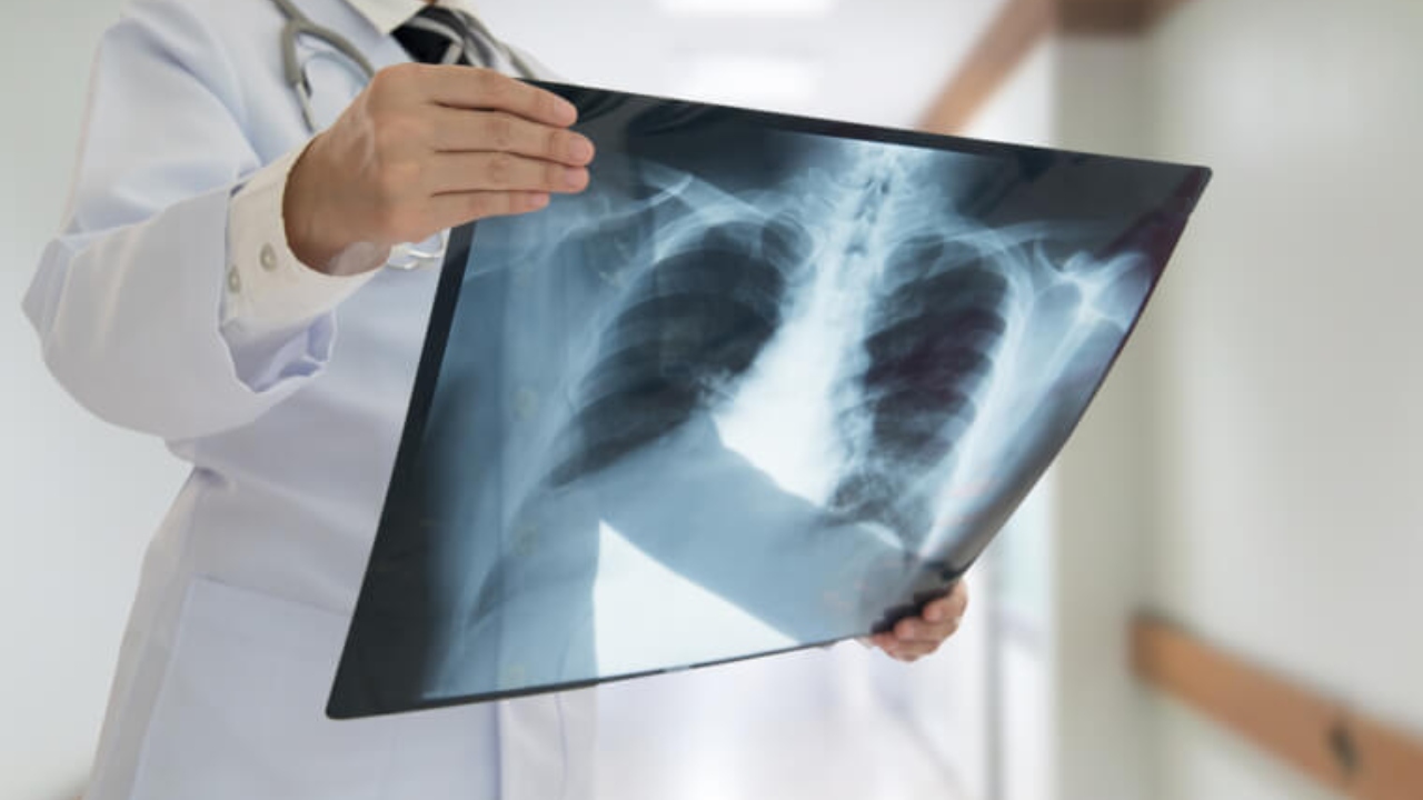 X-ray nedir? X-ray keşfi 